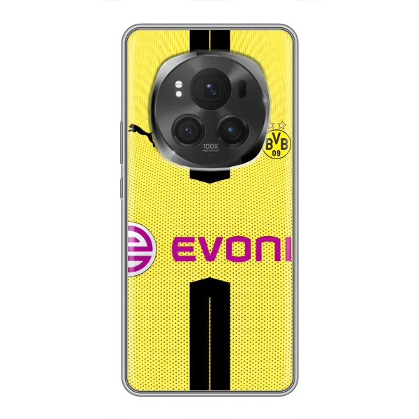 Чехол с принтом «BVB» для Vivo X200 PRO