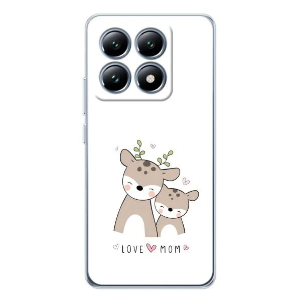 Чехол с принтом «Оленята мама и малыш» для Xiaomi 14T Pro Чехол с принтом «Оленята мама и малыш» для Xiaomi 14T Pro
