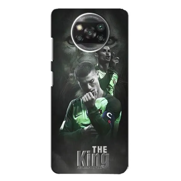 Чохол з принтом «Крістіано Лев» для Xiaomi POCO X3 Pro Чохол з принтом «Крістіано Лев» для Xiaomi POCO X3 Pro