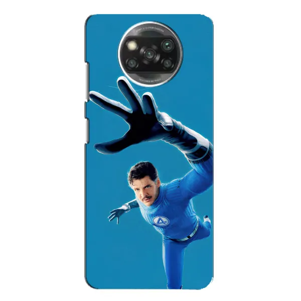 Чехол с принтом «Мистер Фантастик супергерой» для Xiaomi POCO X3 Pro Чехол с принтом «Мистер Фантастик супергерой» для Xiaomi POCO X3 Pro