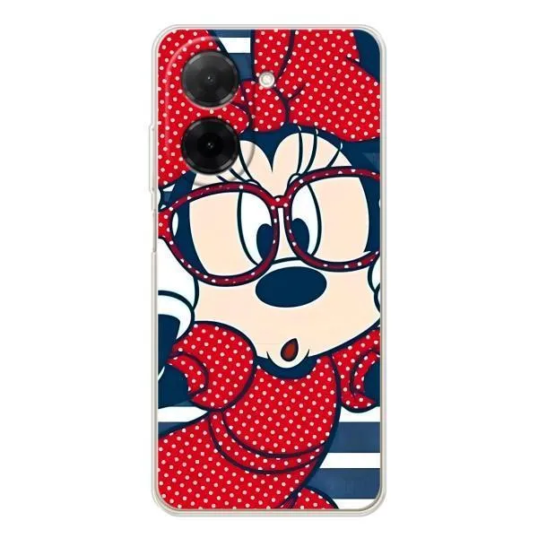 Чехол с принтом «Маус в очках» для Xiaomi Redmi A5 (EU) Чехол с принтом «Маус в очках» для Xiaomi Redmi A5 (EU)