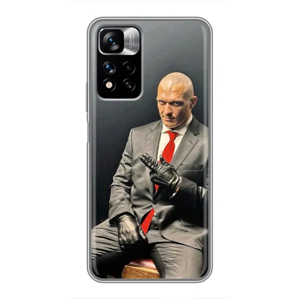 Чехол с принтом «Усик Hitman» для Xiaomi Redmi Note 11 Pro Plus Чехол с принтом «Усик Hitman» для Xiaomi Redmi Note 11 Pro Plus