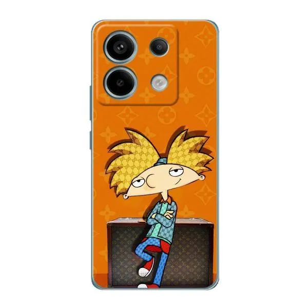Чехол с принтом «Арнольд» для Xiaomi Redmi Note 13 Pro (5G)