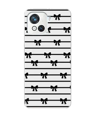 Чехол для Blackview Oscal C80 с картинкой «Полосатый ритм»