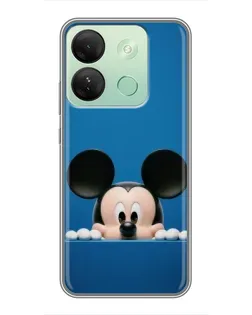 Чохол для Infinix Smart 7 HD з картинкою «Міккі виглядає»