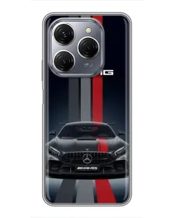 Чохол для TECNO Spark 20 Pro з картинкою «Mercedes — білий карбон» Чохол для TECNO Spark 20 Pro з картинкою «Mercedes — білий карбон»