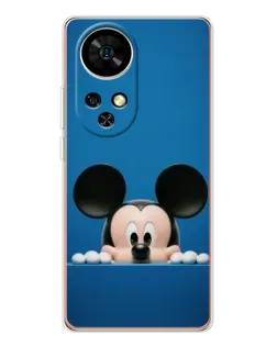 Чехол для Ulefone Note 17 Pro с картинкой «Микки выглядывает» Чехол для Ulefone Note 17 Pro с картинкой «Микки выглядывает»