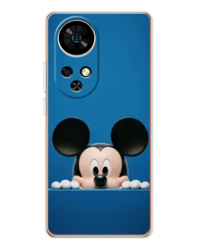 Чехол для Ulefone Note 17 Pro с картинкой «Микки выглядывает» Чехол для Ulefone Note 17 Pro с картинкой «Микки выглядывает»
