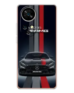Чехол для Ulefone Note 17 Pro с картинкой «Mercedes — белый карбон»