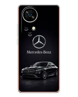 Чехол для Ulefone Note 17 Pro с картинкой «Mercedes — решетка радиатора»