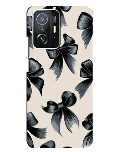 Чехол для Xiaomi 11T / 11T Pro с картинкой «Банты Coquette» Чехол для Xiaomi 11T / 11T Pro с картинкой «Банты Coquette»