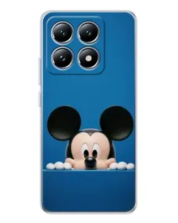 Чехол для Xiaomi 14T с картинкой «Микки выглядывает»