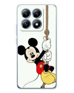 Чехол для Xiaomi 15 Pro с картинкой «Mickey на канате» Чехол для Xiaomi 15 Pro с картинкой «Mickey на канате»