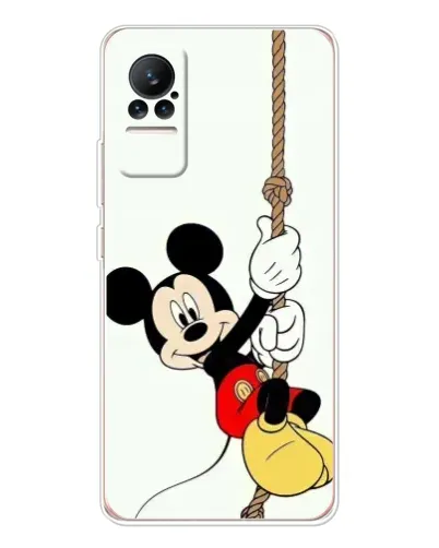 Чехол для Xiaomi Civi с картинкой «Mickey на канате»