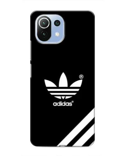 Чехол для Xiaomi Mi 11 Lite с картинкой «Adidas с диагональными полосами» Чехол для Xiaomi Mi 11 Lite с картинкой «Adidas с диагональными полосами»