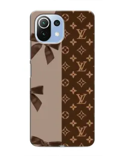 Чехол для Xiaomi Mi 11 Lite с картинкой «Louis Vuitton — банты»