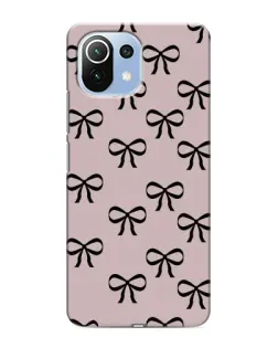 Чехол для Xiaomi Mi 11 Lite с картинкой «Черные бантики» Чехол для Xiaomi Mi 11 Lite с картинкой «Черные бантики»