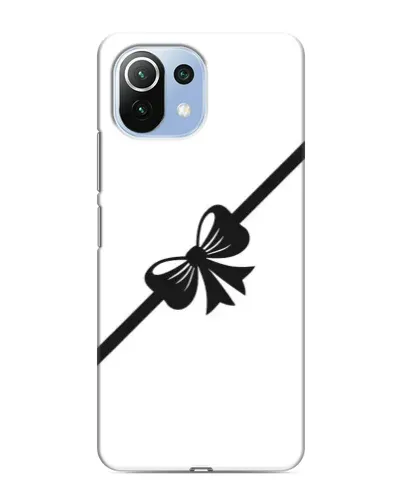 Чехол для Xiaomi Mi 11i с картинкой «Диагональный бант» Чехол для Xiaomi Mi 11i с картинкой «Диагональный бант»