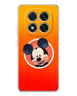 Чехол для Xiaomi Redmi Note 15 Pro 5G с картинкой «Mickey в круге»