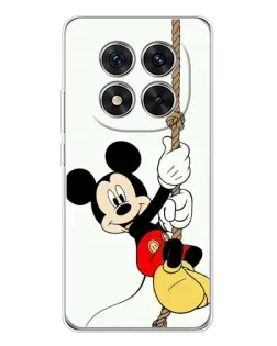 Чехол для Xiaomi Redmi Note 15 Pro 5G с картинкой «Mickey на канате»