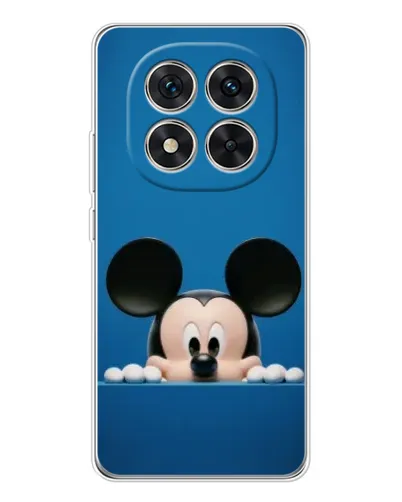 Чехол для Xiaomi Redmi Note 15 Pro Plus с картинкой «Микки выглядывает»