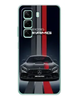 Чохол для Xiaomi Redmi Note 15R з картинкою «Mercedes — білий карбон»