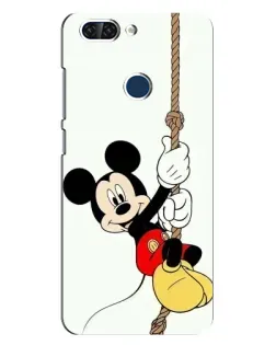 Чохол для ZTE Blade V9 з картинкою «Mickey на канаті» Чохол для ZTE Blade V9 з картинкою «Mickey на канаті»