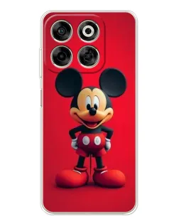Чехол для ZTE Nubia V70 с картинкой «Mickey в полный рост»