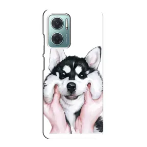 Чохол з Хаскі Xiaomi Redmi Note 11E - (AlphaPrint)