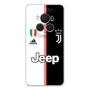 Чохли для Huawei Honor Magic 7 Pro (VPrint) - Футбольні клуби (Juventus)