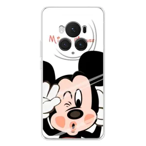 Міккі Маус чохол для Huawei Honor Magic 7 Pro (AlphaPrint - Мультяшні) (Маус Міккі)