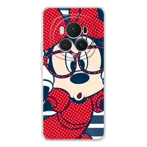 Міккі Маус чохол для Huawei Honor Magic 7 Pro (AlphaPrint - Мультяшні) (Маус в окулярах)