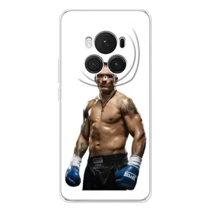 Чохол з принтом «Усик на білому» для Huawei Honor Magic 7 Pro