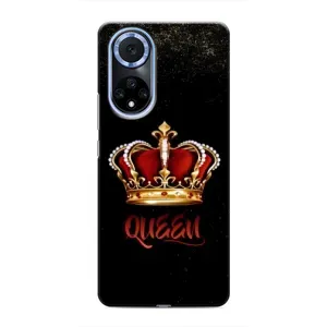 Чехол с принтом «Корона короля» для Huawei Honor X7b
