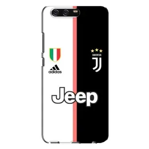Чохли для Huawei P10 Plus, VKY (VPrint) - Футбольні клуби (Juventus)