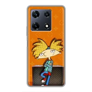 Чохол з принтом «Арнольд» для Infinix Note 30 Pro