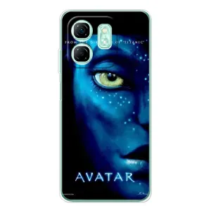 Чохол з принтом «око Аватара» для Infinix Smart 9