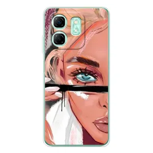 Чехол с печатью для Infinix Smart 9 - (Мода) (AlphaPrint)