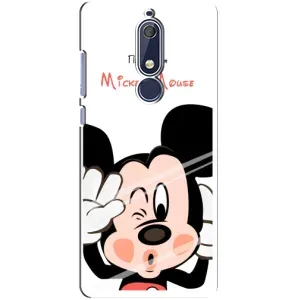 Эксклюзивный чехол для Nokia 5 2018, 5.1 (AlphaPrint - Мультяшные) (Маус Микки)
