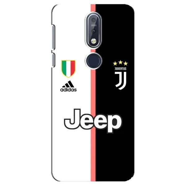 Чехол с принтом «Juventus» для Nokia 7.1 (2018)