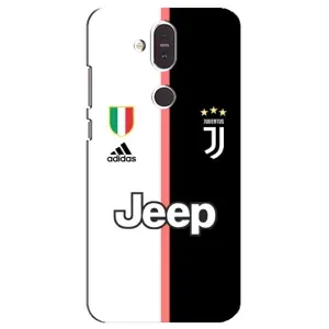 Чехлы для Nokia 8.1 , Nokia 8 2018 (VPrint) - Футбольные клубы (Juventus)
