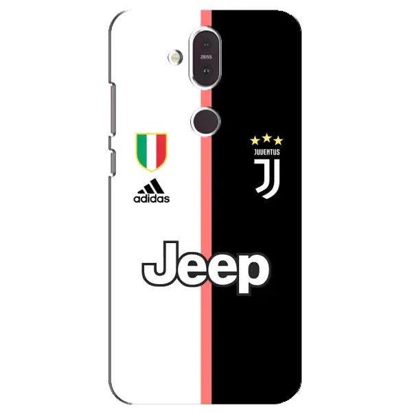 Чехол с принтом «Juventus» для Nokia 8.1 (2018)