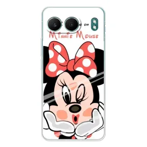 Эксклюзивный чехол для OnePlus Nord 4 (AlphaPrint - Мультяшные)
