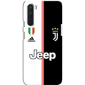Чохли для OnePlus Nord (VPrint) - Футбольні клуби (Juventus)
