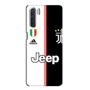 Чохли для Oppo A91 (VPrint) - Футбольні клуби (Juventus)