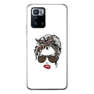 Чехлы Луи Витон для Xiaomi POCO X3 GT (AlphaPrint - LOUIS VUITTON) (стильная с луи витон)