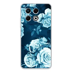 Чехлы (ART) Цветы на TECNO Spark 30 Pro (VPrint) (Голубые Бутоны)