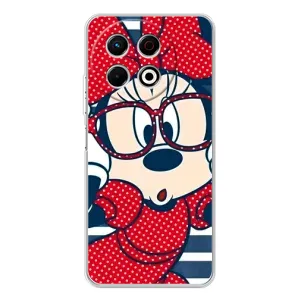 Эксклюзивный чехол для TECNO Spark 30 Pro (AlphaPrint - Мультяшные) (Маус в очках)