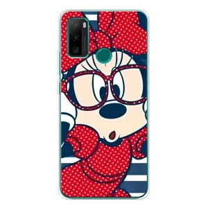 Эксклюзивный чехол для Ulefone Note 10P (AlphaPrint - Мультяшные) (Маус в очках)