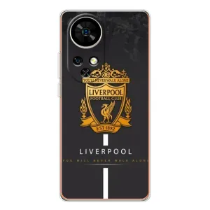 Чехлы для Нот 17 Про (VPrint) - ТОП ФК (FC Liverpool)